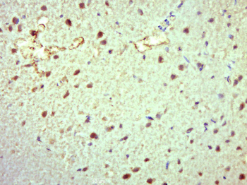 TTC33 Rabbit Polyclonal Antibody