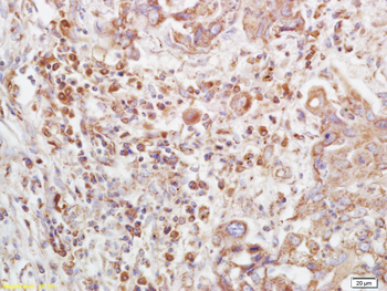 Phospho-ATM (Ser1981) Rabbit Polyclonal Antibody