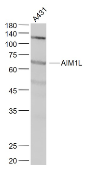 AIM1L Rabbit Polyclonal Antibody