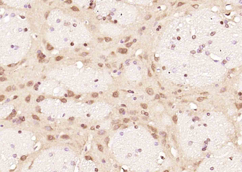 HnRNP C1/C2 Rabbit Polyclonal Antibody