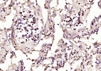 NCF1 Rabbit Polyclonal Antibody