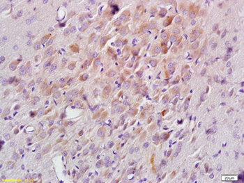 NCF1 Rabbit Polyclonal Antibody