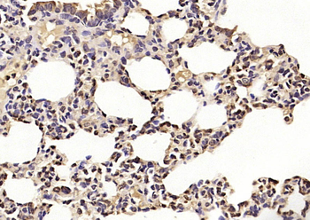 STIP1 Rabbit Polyclonal Antibody