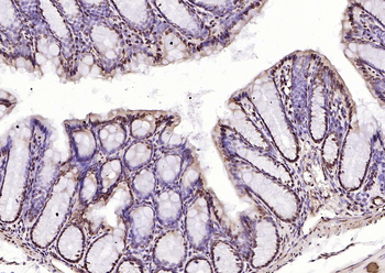 Phospho-SRF (Ser77) Rabbit Polyclonal Antibody