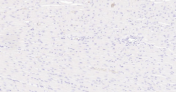 Ki67 Recombinant Rabbit Monoclonal Antibody