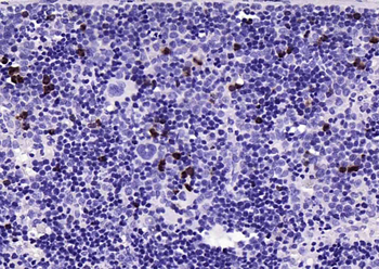 Ki67 Recombinant Rabbit Monoclonal Antibody