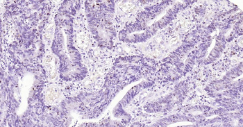 Ki67 Recombinant Rabbit Monoclonal Antibody