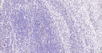 Ki67 Recombinant Rabbit Monoclonal Antibody