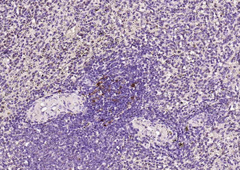 SQSTM1/p62 Recombinant Rabbit Monoclonal Antibody