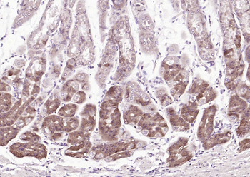 SQSTM1/p62 Recombinant Rabbit Monoclonal Antibody