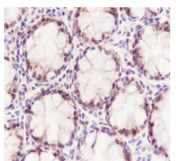 HMGB2 Recombinant Rabbit Monoclonal Antibody