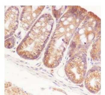 NFKB2 Recombinant Rabbit Monoclonal Antibody