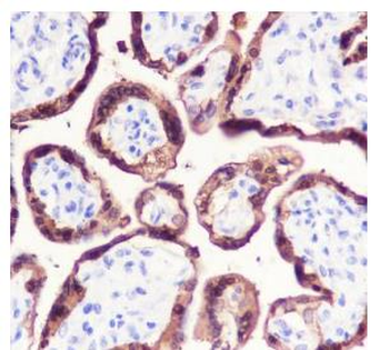 HSD17B1 Recombinant Rabbit Monoclonal Antibody