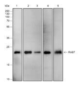RAB7A Recombinant Rabbit Monoclonal Antibody