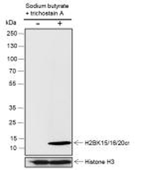 Histone H2B (Crotonyl-Lys15 / Lys16 / Lys20) Recombinant Rabbit Monoclonal Antibody