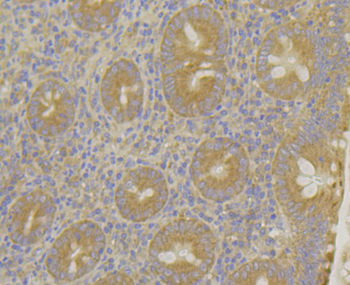 MARK2 Recombinant Rabbit Monoclonal Antibody