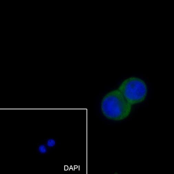 MMP3 Recombinant Rabbit Monoclonal Antibody