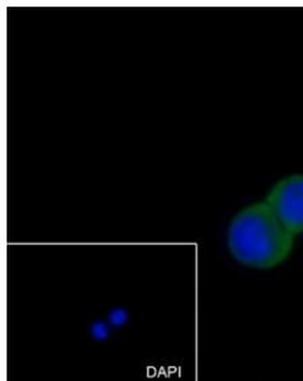 MMP3 Recombinant Rabbit Monoclonal Antibody
