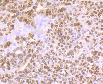 PAX8 Recombinant Rabbit Monoclonal Antibody