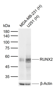 RUNX2 Recombinant Rabbit Monoclonal Antibody