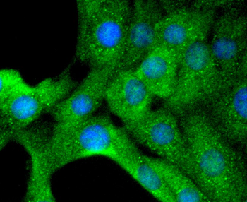 Tyrosine Hydroxylase Recombinant Rabbit Monoclonal Antibody