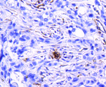 ITGB3 Recombinant Rabbit Monoclonal Antibody