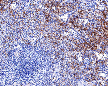 ITGB3 Recombinant Rabbit Monoclonal Antibody