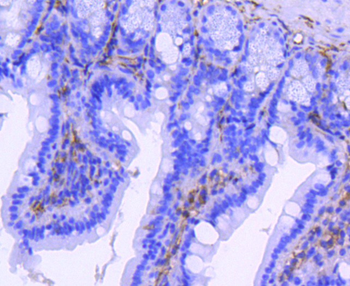 ITGB3 Recombinant Rabbit Monoclonal Antibody