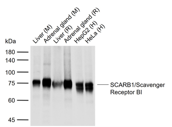 SCARB1/Scavenger Receptor BI Recombinant Rabbit Monoclonal Antibody