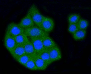 SCARB1/Scavenger Receptor BI Recombinant Rabbit Monoclonal Antibody