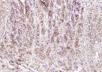 SCARB1/Scavenger Receptor BI Recombinant Rabbit Monoclonal Antibody