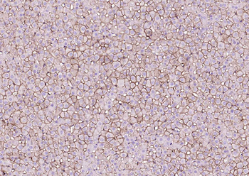 SCARB1/Scavenger Receptor BI Recombinant Rabbit Monoclonal Antibody