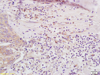 PSMB8 Rabbit Polyclonal Antibody