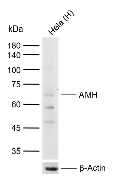 AMH Rabbit Polyclonal Antibody