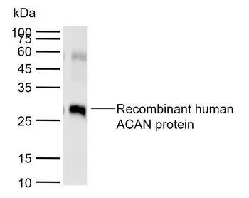 ACAN Rabbit Polyclonal Antibody