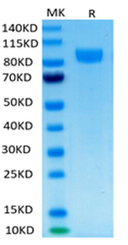 Recombinant human ErbB2 / Her2 protein, C-His-Avi (HEK293)