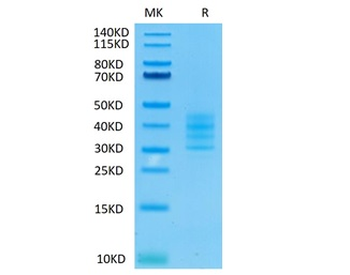 Recombinant human BCMA (Trimer) protein, C-His-Avi (HEK293)