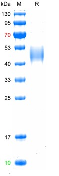 Recombinant human NMP-22 protein, His (HEK293)