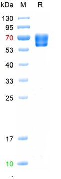 Recombinant human Haptoglobin, His (HEK293)