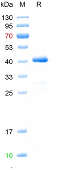 Recombinant human Beclin 1 protein, N-His