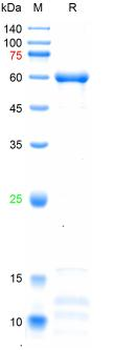 Recombinant human CD105 protein, C-His