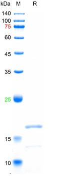Recombinant human SAA1 protein, His tag