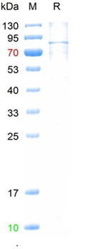 Recombinant human Vcam1 protein, C-His