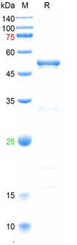 Recombinant human P53 protein, C-His