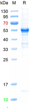 Recombinant human P53 protein, C-His