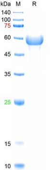Recombinant human CD105 protein, C-His