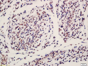 IGF2BP1 Rabbit Polyclonal Antibody