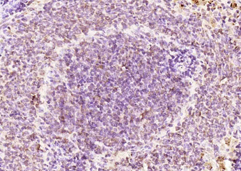 RPUSD2 Rabbit Polyclonal Antibody
