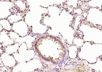 RPUSD2 Rabbit Polyclonal Antibody