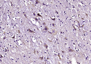 PDZD9 Rabbit Polyclonal Antibody